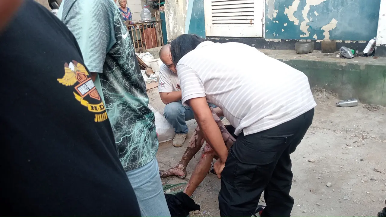 Diduga Mencuri Kabel, Seorang Pria Mengalami Luka Bakar Parah Akibat Tersengat Listrik