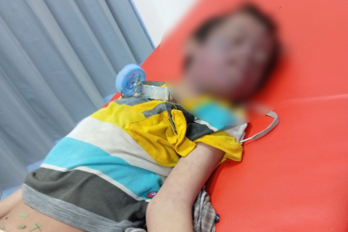 Perundung Anak Disabilitas di Surabaya Diperiksa Psikologisnya di RSJ Menur