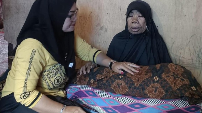 Terungkap Kondisi Medis Balita Nakla Syafira Sebelum Meninggal, Alami Gizi Buruk hingga Komplikasi Serius